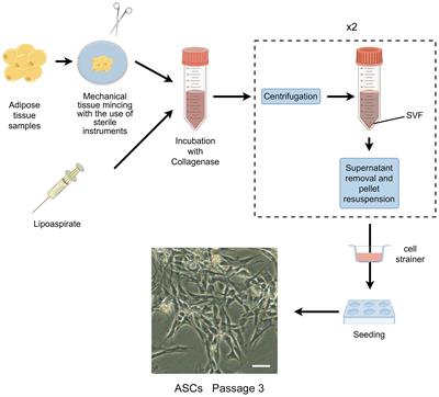Advancements in culture technology of adipose-derived stromal/stem cells: implications for diabetes and its complications